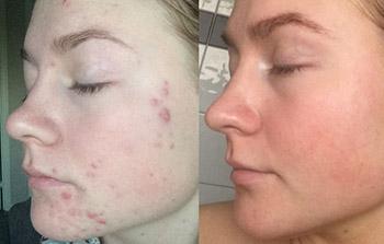 I CAN MAKE YOUR SKIN NICE & SMOOTH, FREE OF ANY ...