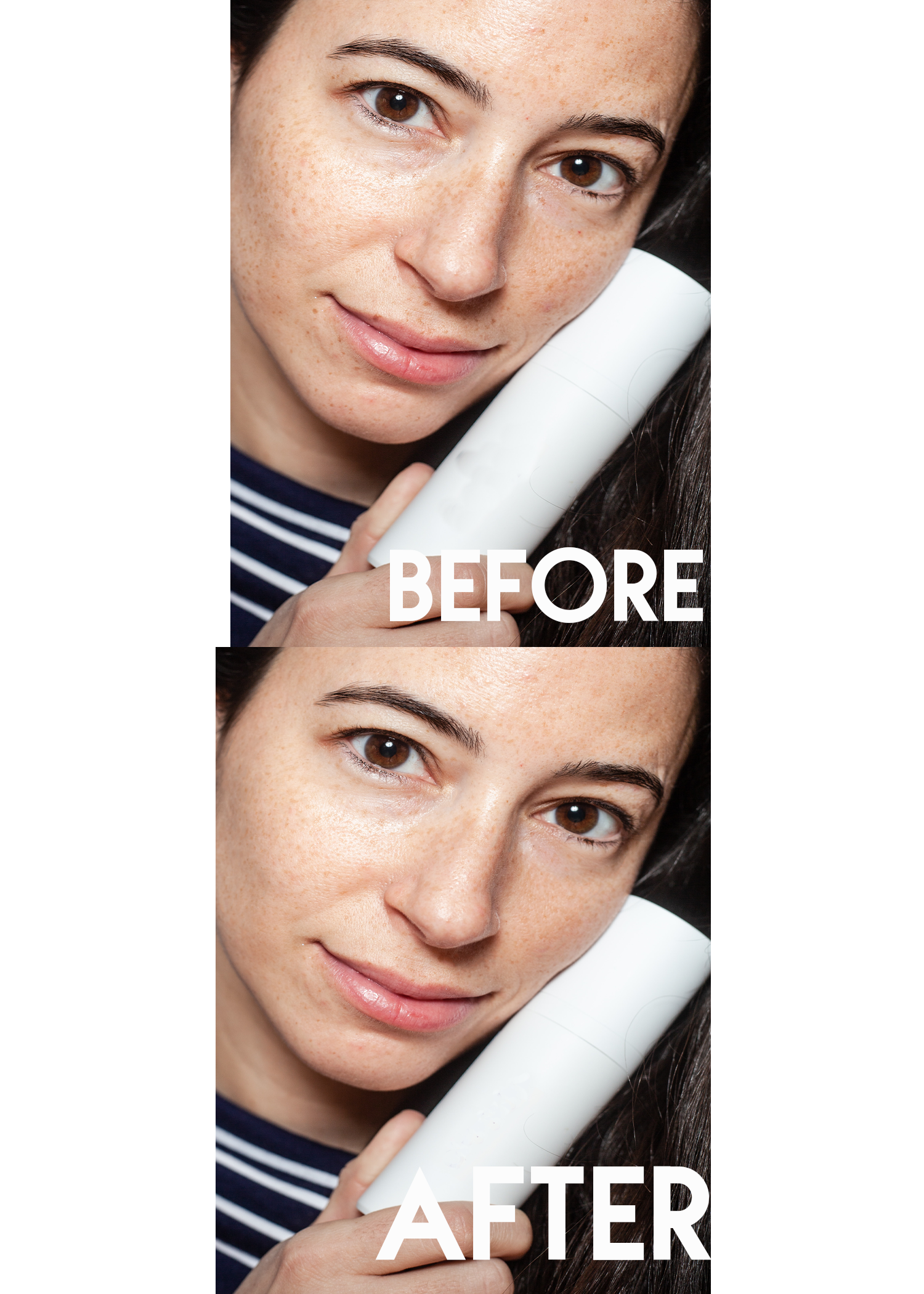 Skin Spots and Defects Gone Forever