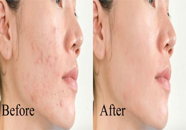 I will do photo editing and skin retouching within 24...