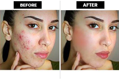 I will do any type of Photo Retouching and Photo Edit...