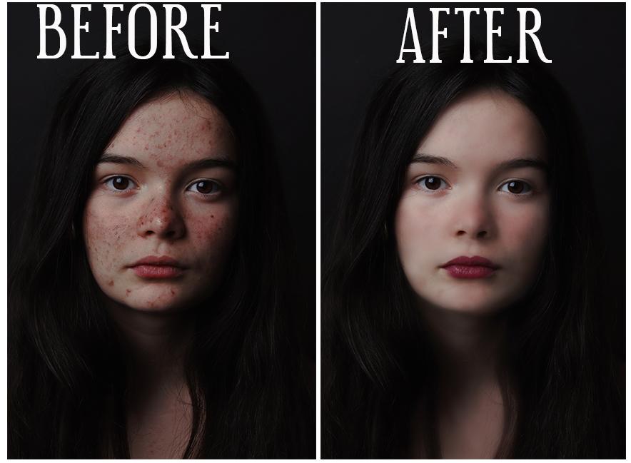 I will remove or change or blur background & phot...