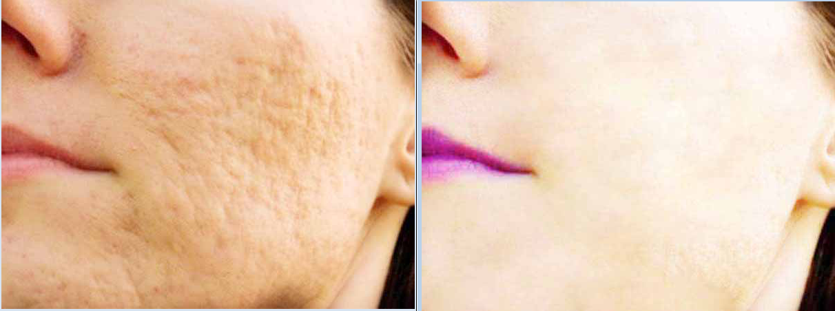 I will do any photoshop editing and photo manipulatio...