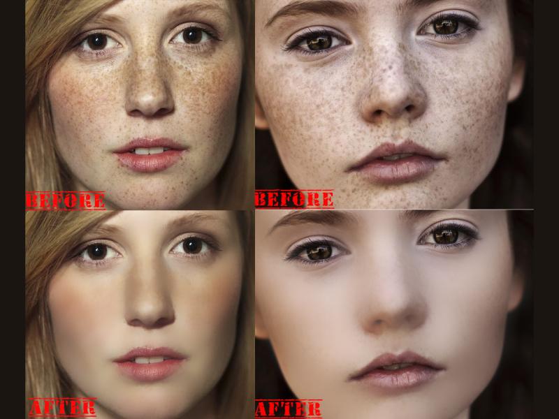 I will remove spots on your face within 2 hr