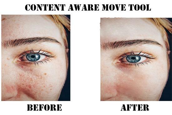 I will remove pimple dark spot and heal face and your...