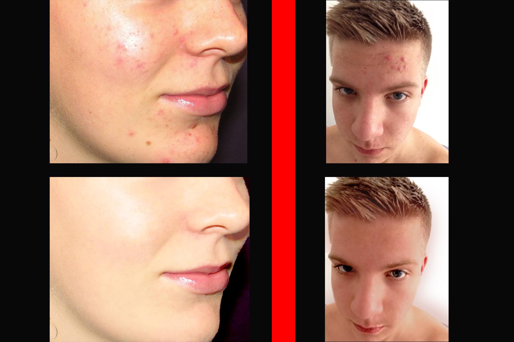 photo editing, banner design, background removing