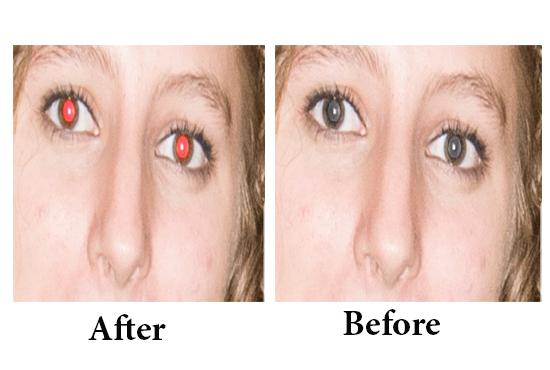 I will do 05 remove red eye or Remove Background