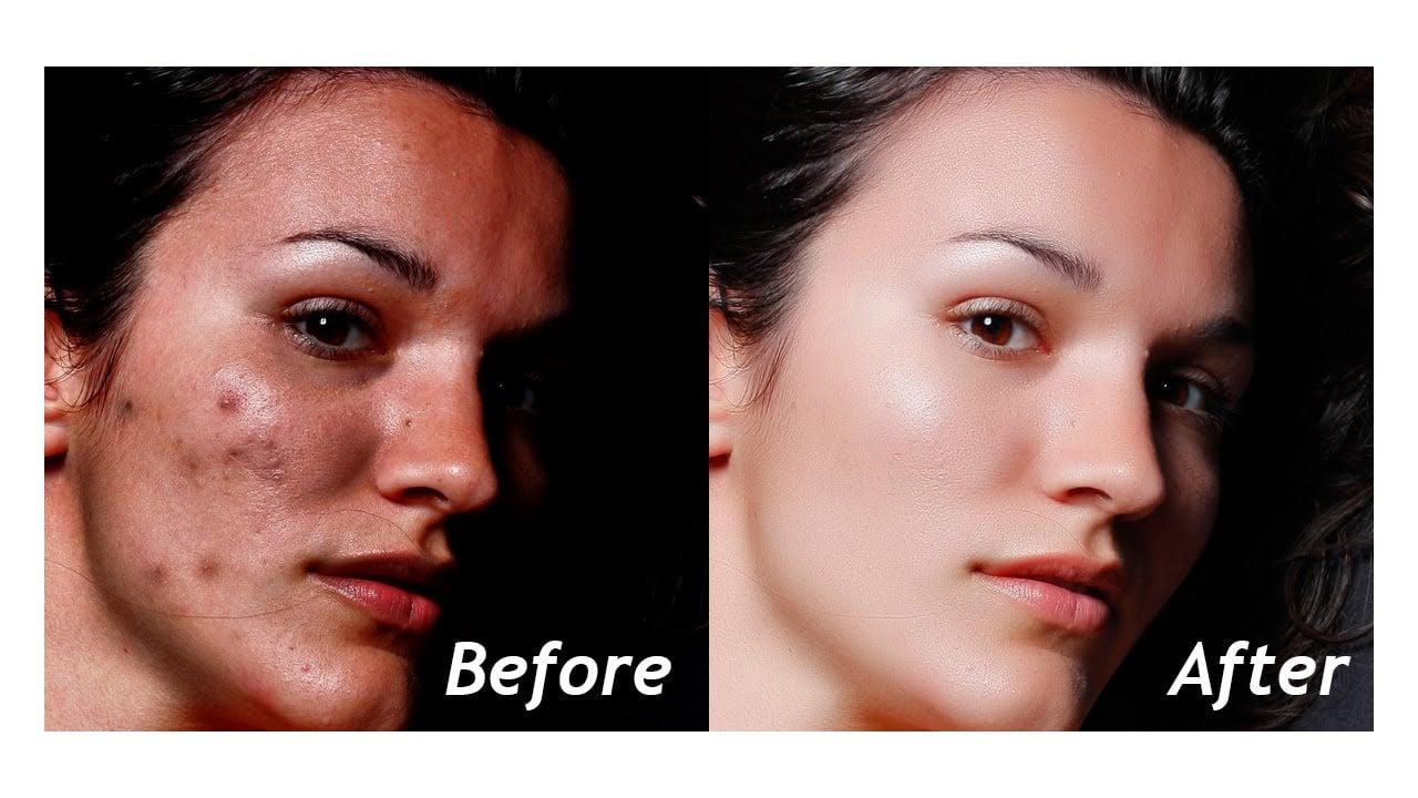 Photo Retouching & Enhancement (Photoshop Editing)