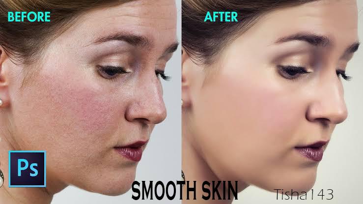 Professional High-End Skin Re-touch Remove Blemishes, Wrinkles, Acne fast delivery