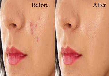 I will do photo editing and skin retouching within 24 hours