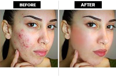 I will do any type of Photo Retouching and Photo Editing as your requirment