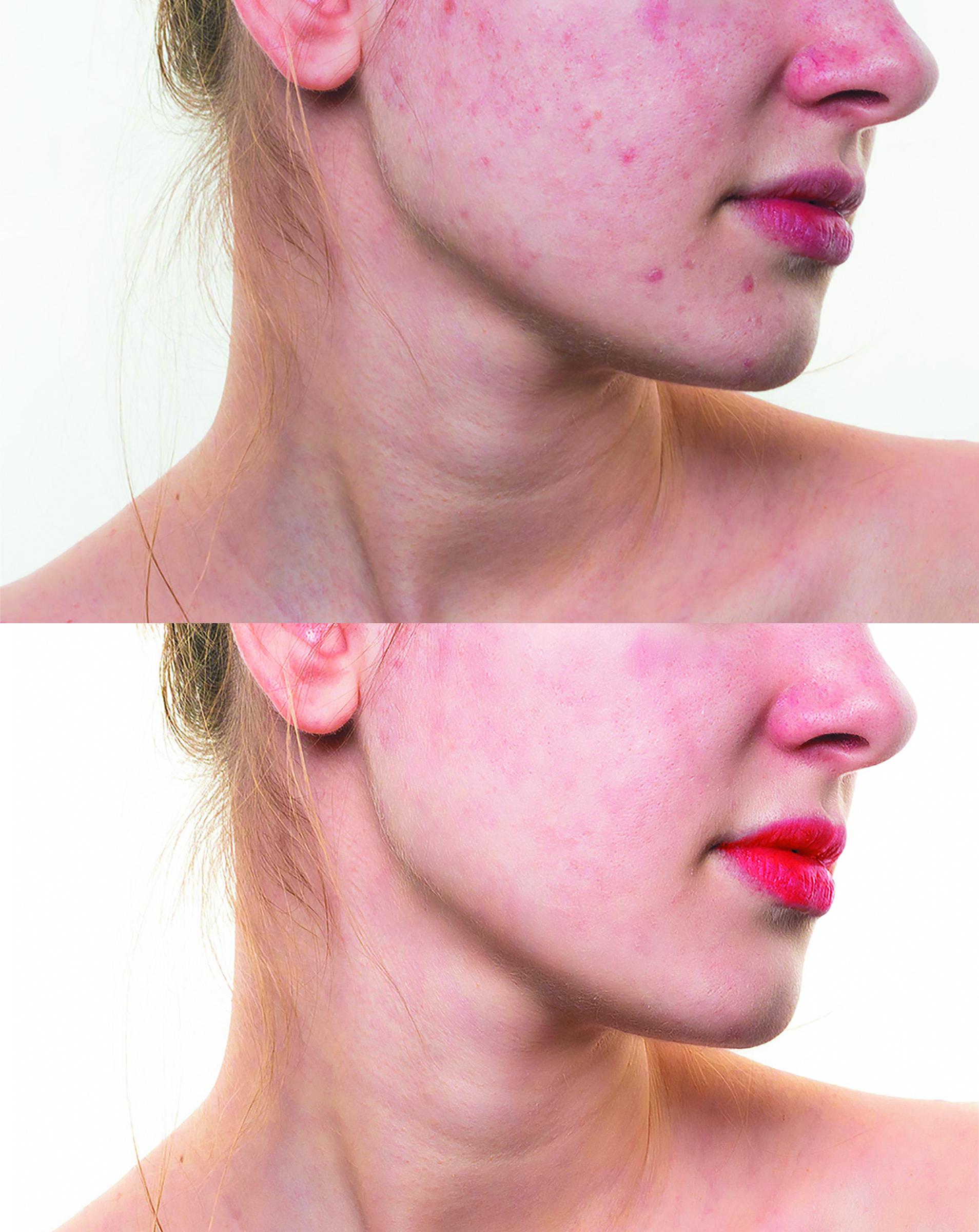  I will do Photo editing, retouching and colour correction professionally