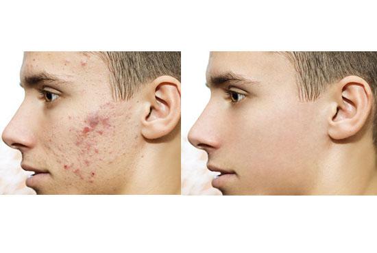 i can retouch all kind of photo