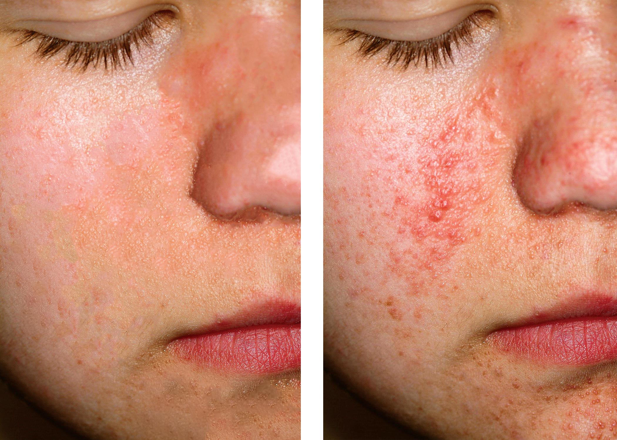 I will photo retouch, colour changeing, and photoshop edit photos 4 images