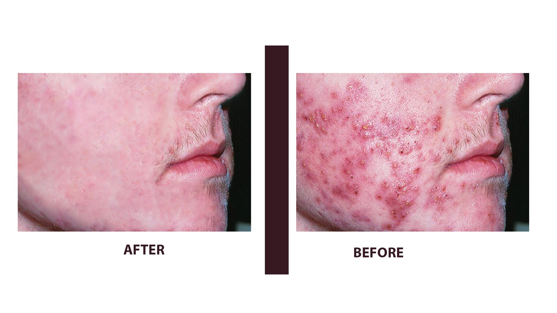 I will do any kind of photo editing