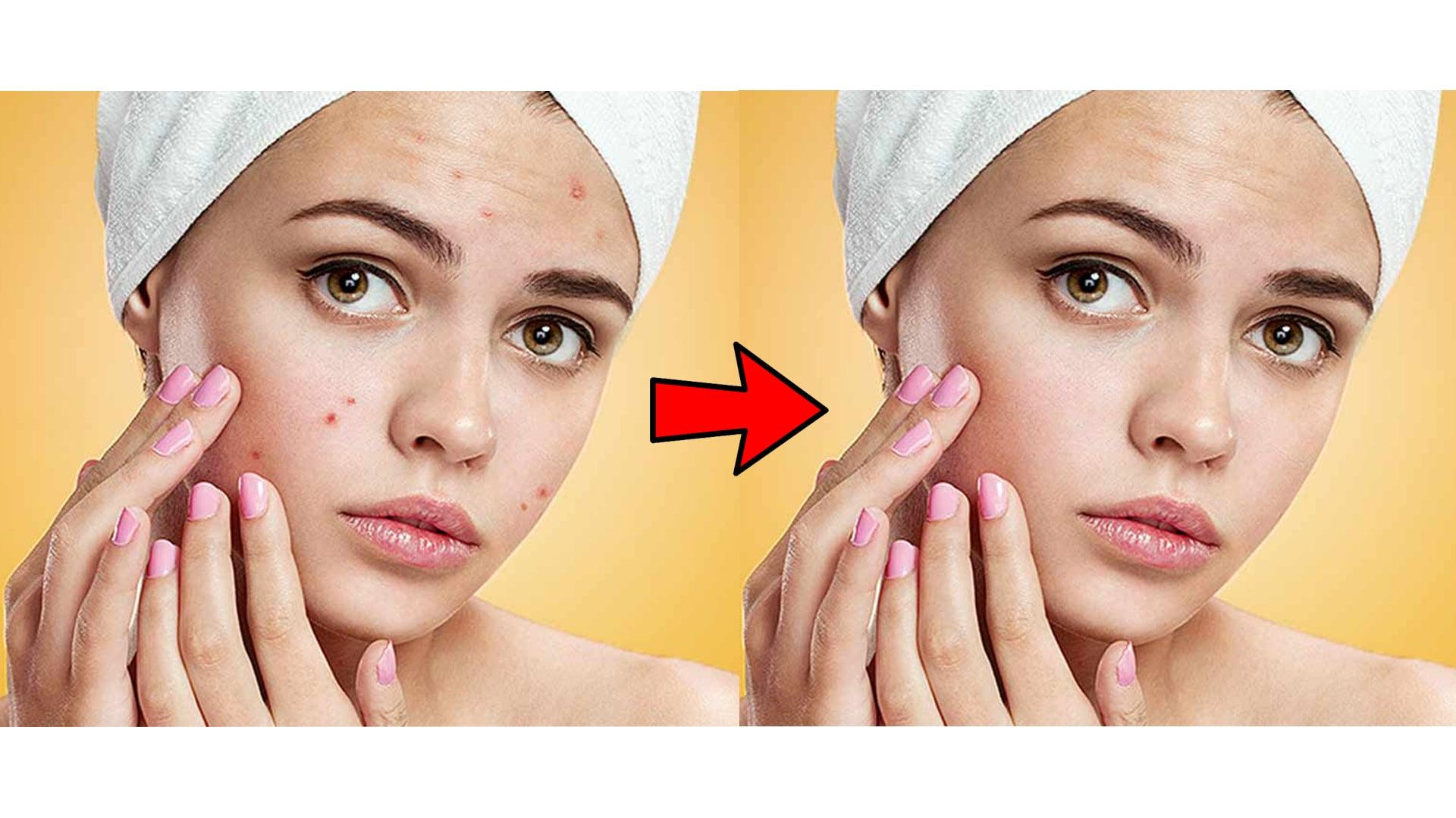 I will professionaly EDIT or CORRECT your pictures.