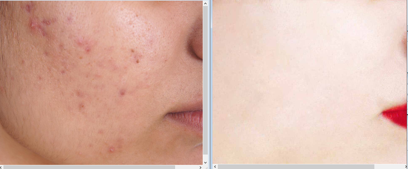 I will do any photoshop editing and photo manipulation