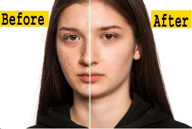 i will Photoshop remove background 20 images