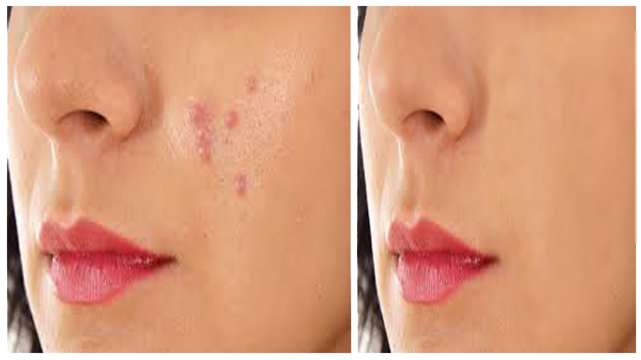 I will do Adobe Photoshop editing