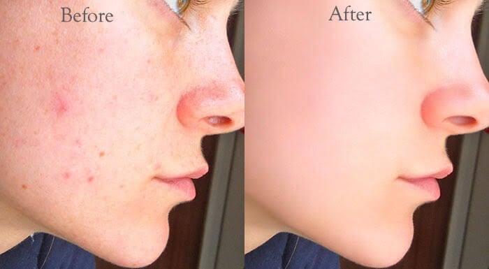 Change and remove photo background with retouching 5 photos