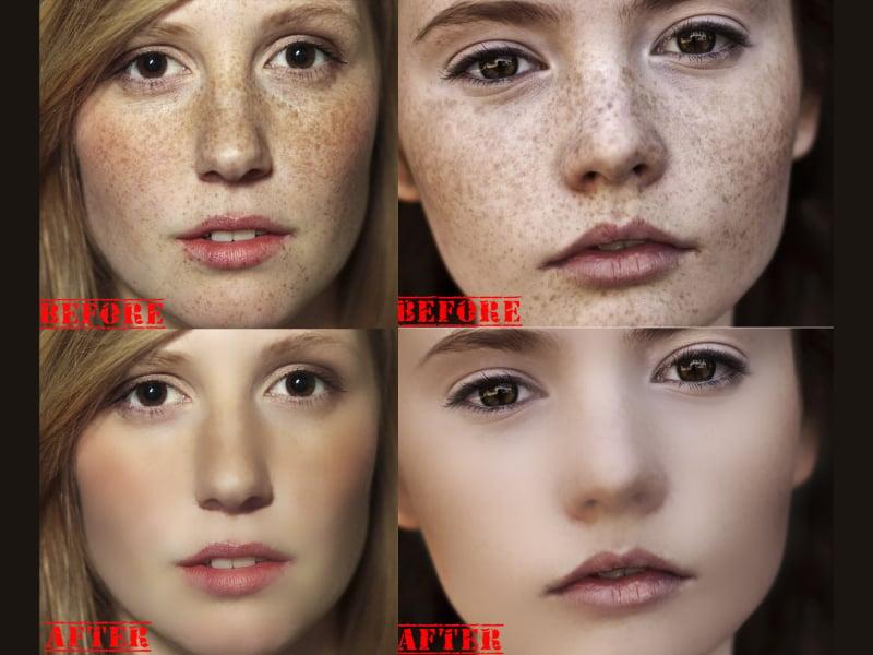 I will remove spots on your face within 2 hr