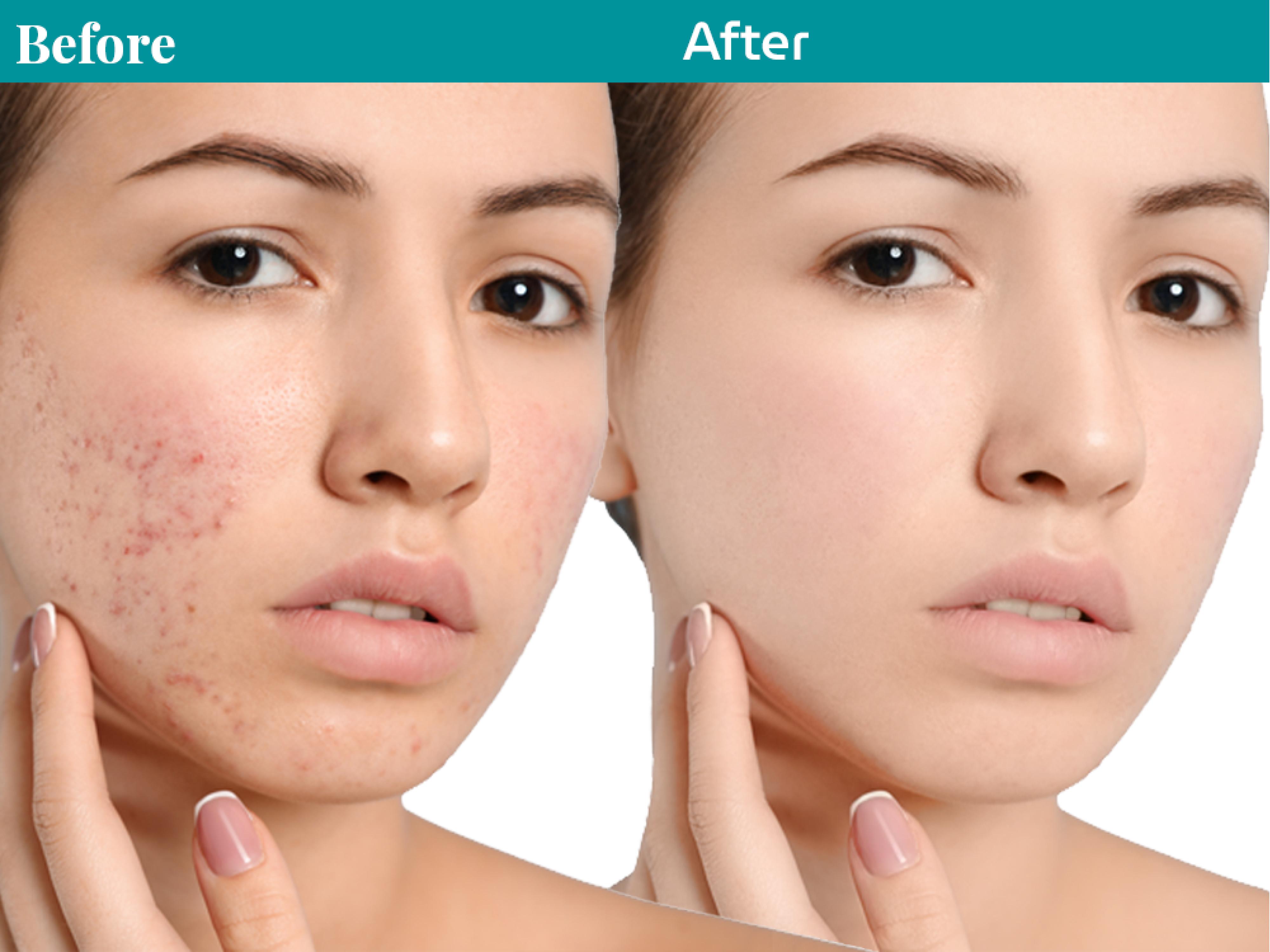 You will get Nice Photo editing & Image retouching very fast