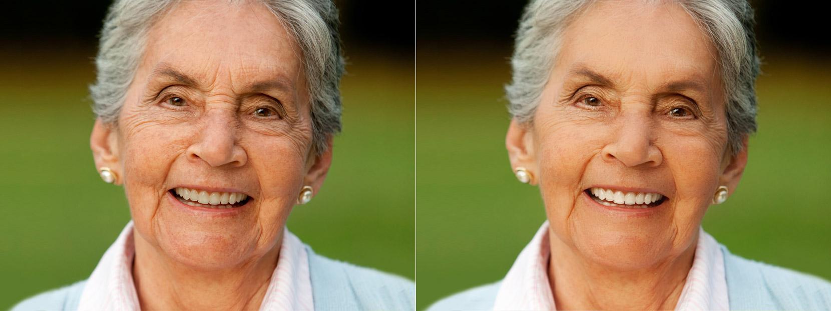 Fast Photo Editing, Photo Retouch, Image Resize