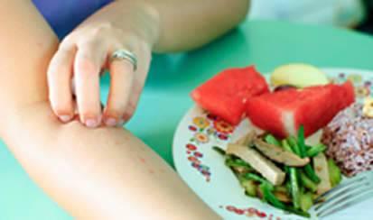 How To Manage And Treat Food Allergies Symptoms 