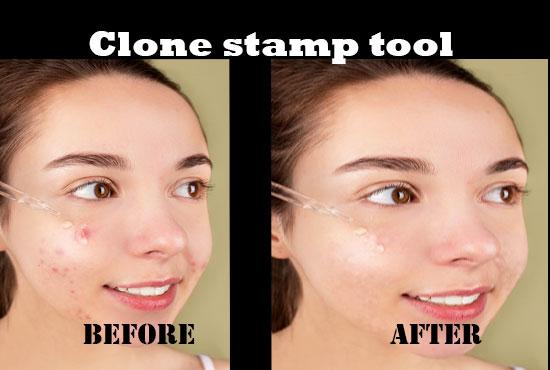 I will remove pimple dark spot and heal face and your background