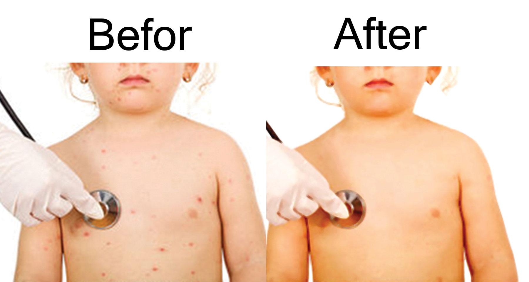 I DO REMOVE 20 IMAGE BACKGROUND AND EDIT PHOTO PIMPLE PROPERLY 24 HOUR