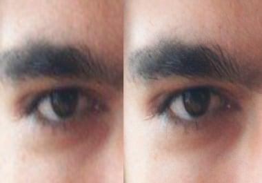 Image Upscale & Enhance With AI 5 Photos