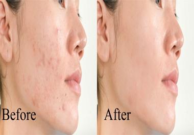 I will do photo editing and skin retouching within 24 hours