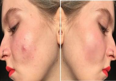 I will professionally retouch or editing any photo