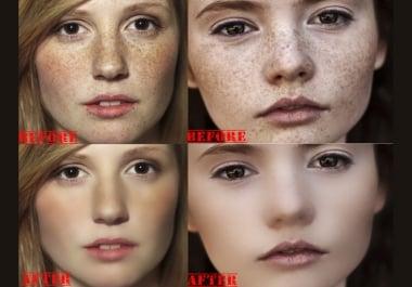 I will remove spots on your face within 2 hr