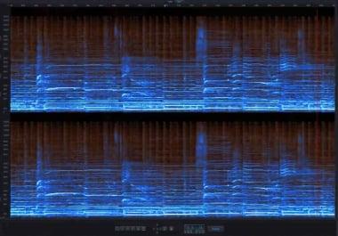 Audio Acapella / Instrumental Service